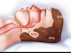 Finding Rest Again: Understanding and Managing Obstructive Sleep Apnea
